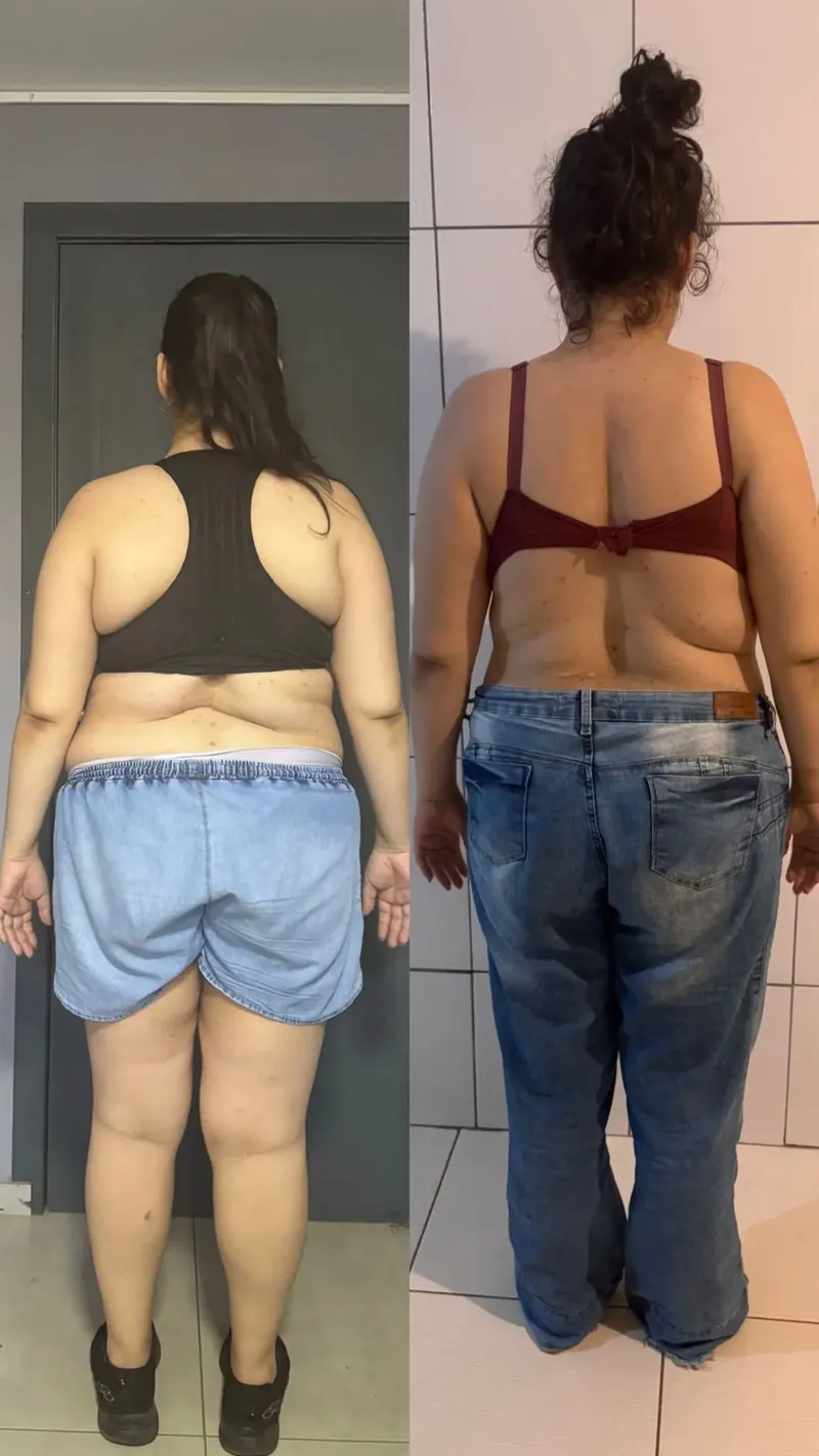 Antes e depois — visão de costas