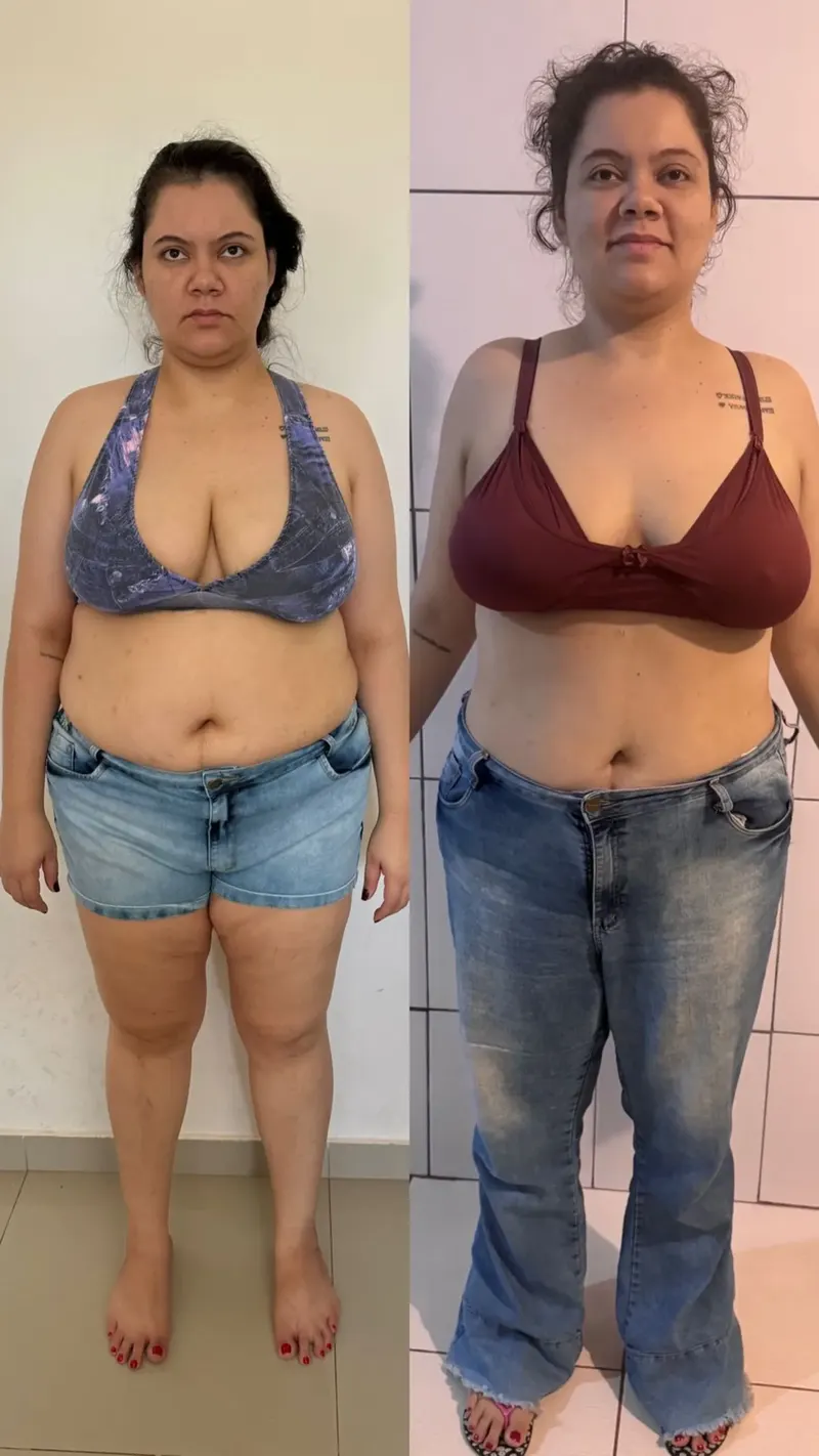 Antes e depois — visão de frente